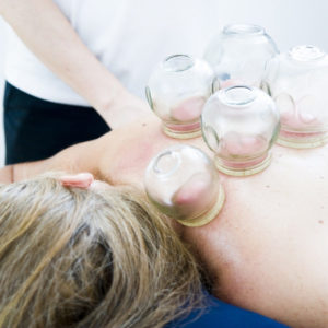 Wellbeing clinic traditional chinese medicine hot cupping