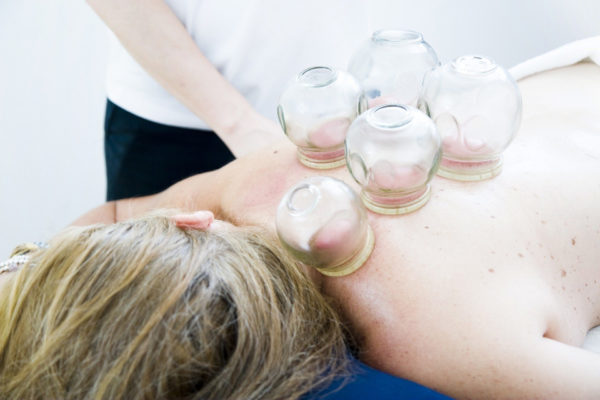 Wellbeing clinic traditional chinese medicine hot cupping